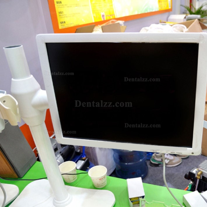 17インチ高精度デジタルLCD AIOモニター歯科口内カメラ Wifi